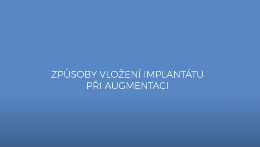 Způsoby vložení implantátu při zvětšení prsou